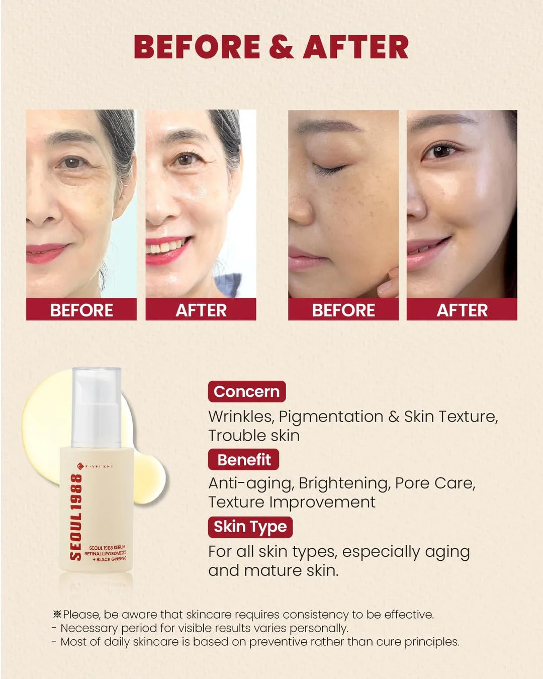KSecret Seoul1988 Serum: Retinal Liposome 2% + Black Ginseng